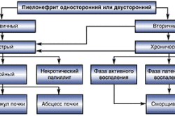 Классификация пиелонефрита