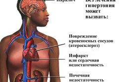 Последствия почечной гипертонии